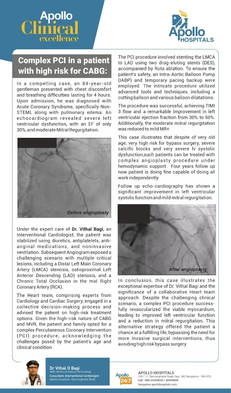 Complex PCI in a patient with high risk for CABG