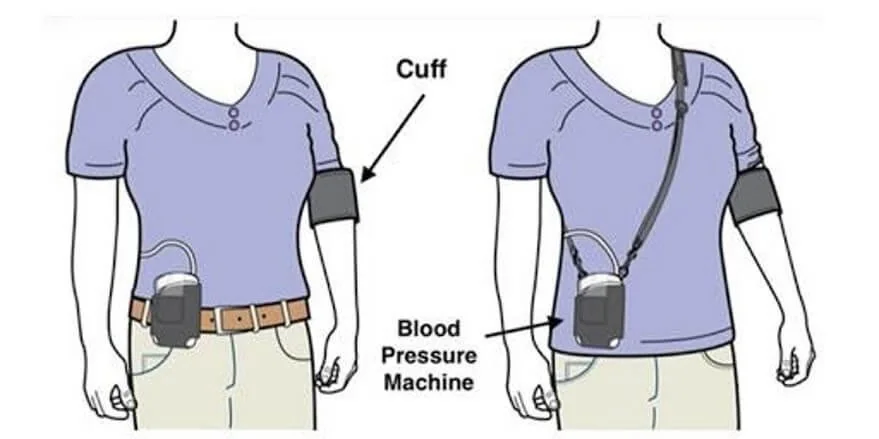 24-Hour Ambulatory Blood Pressure Monitoring