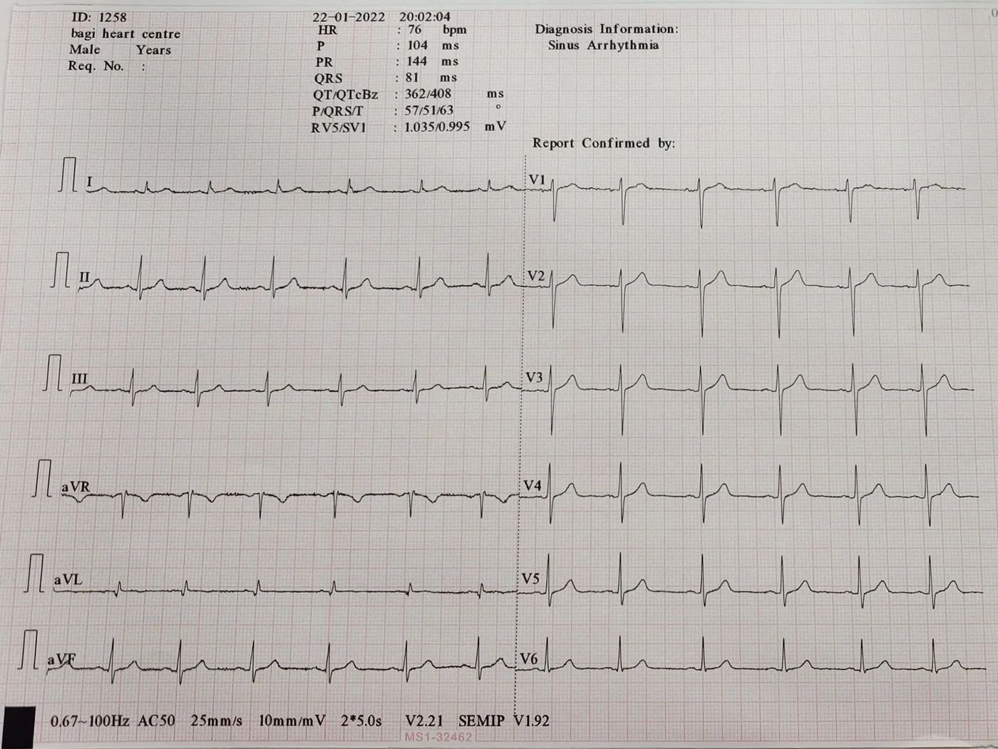 ECG / Electrocardiogram